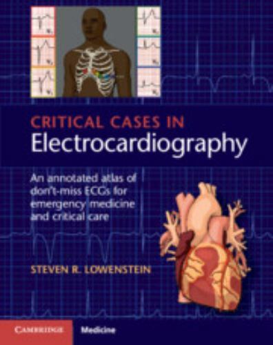 Critical Cases in Electrocardiography: An Annotated Atlas of Don’t-Miss ECGs for